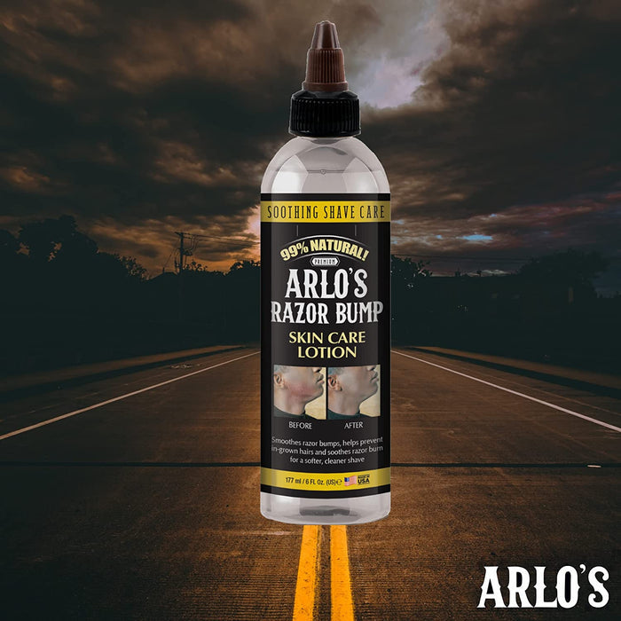 Arlo's Razor Bump Skin Care Lotion 6 oz - Palms Fashion Inc.