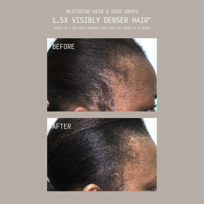 Stacked before and after comparison showing a person's hairline and edges with sparse, thinning hair before and visibly fuller, denser regrowth after using Cécred Restoring Hair & Edge Drops, with text reading "1.5x Visibly Denser Hair"