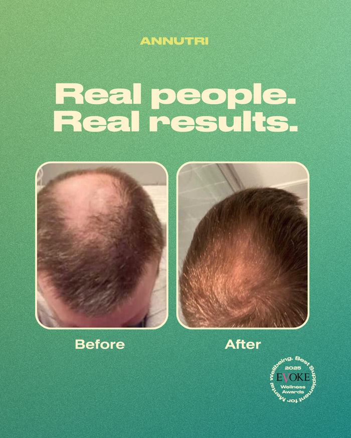 Annutri Grow It Hair Supplements 1 Month Supply (60 Capsules)