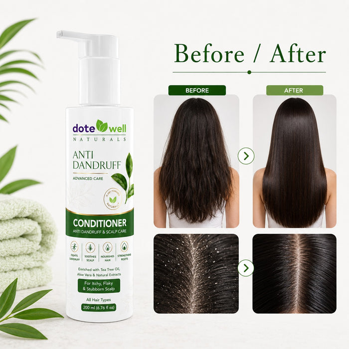 Anti-Dandruff Conditioner for Flake Control & Scalp Nourishment | Smooth Hair Care for Dandruff-Prone Hair | 200ml