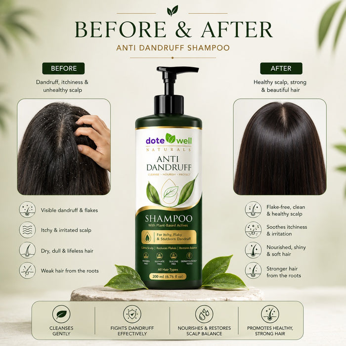Anti-Dandruff Shampoo for Flake Control & Itchy Scalp Relief | Deep Cleansing for Oily & Dandruff-Prone Hair | 200ml