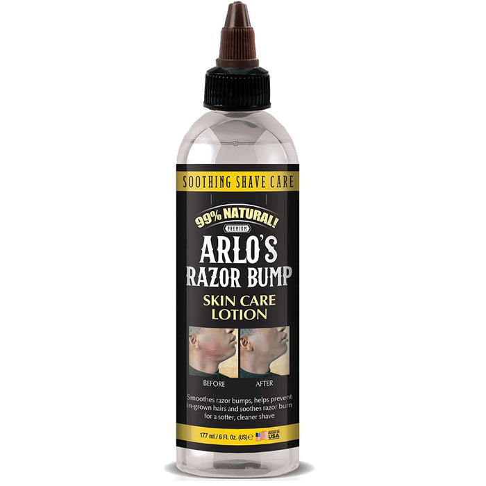 Arlo's Razor Bump Skin Care Lotion 6 oz - Palms Fashion Inc.