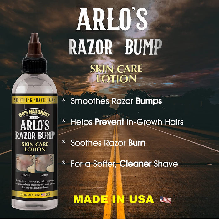 Arlo's Razor Bump Skin Care Lotion 6 oz - Palms Fashion Inc.
