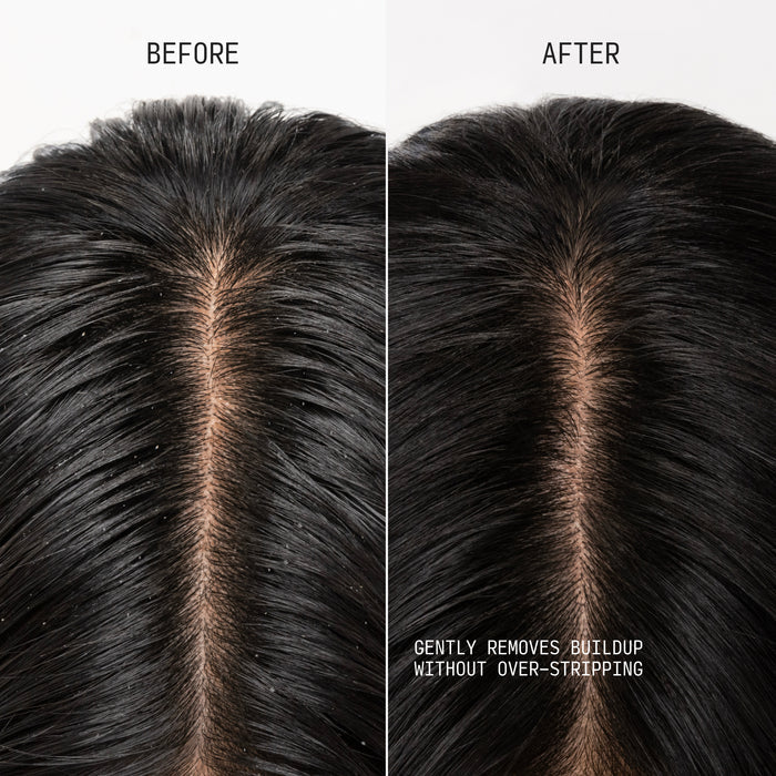 Before and after top view split image showing scalp buildup removal on dark hair using Cécred Clarifying Shampoo & Scalp Scrub, with Gently Removes Buildup Without Over-Stripping claim text