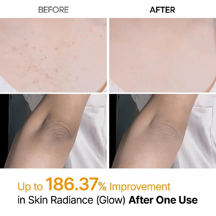 Dr. Melaxin Peel Shot Exfoliating Kojic Acid Turmeric Spray 200ml - Beauty Tribe