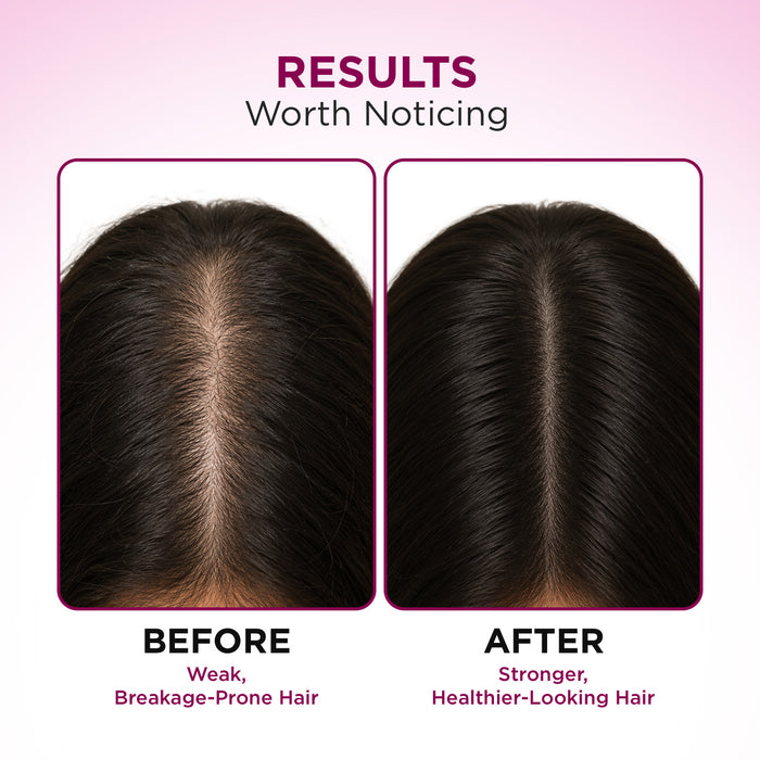 Hair Fall Control Shampoo with Pea Protein & Caffeine for Stronger Hair - 650 ml