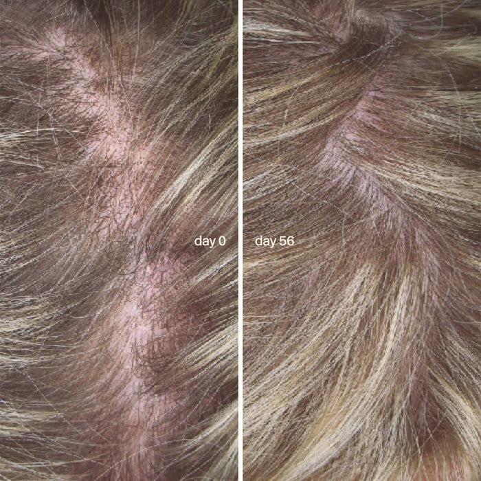 L'Essentiel Cheveux Cure de 3 mois