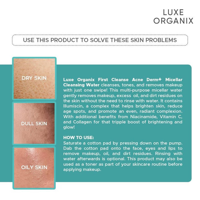 Luxe Organix First Cleanse Acne Derm+ Micellar Cleansing Water 300ml ماء التنظيف الميسيلار لوكس أورجانيكس فيرست كلينز لعلاج حب الشباب ديرم+ - Princess Cosmetics Qatar