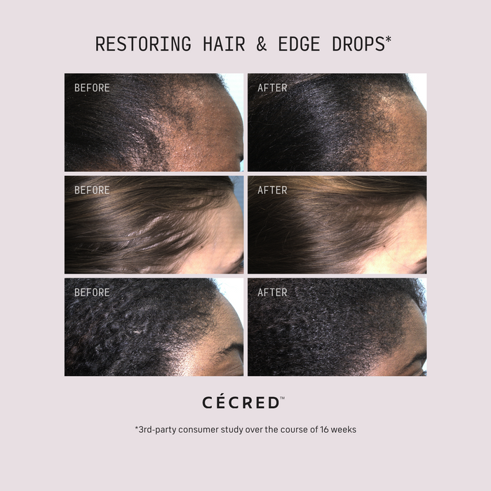 Three-row before and after grid showing diverse hairlines and edge types across different textures with visibly fuller, denser regrowth after using Cécred Restoring Hair & Edge Drops
