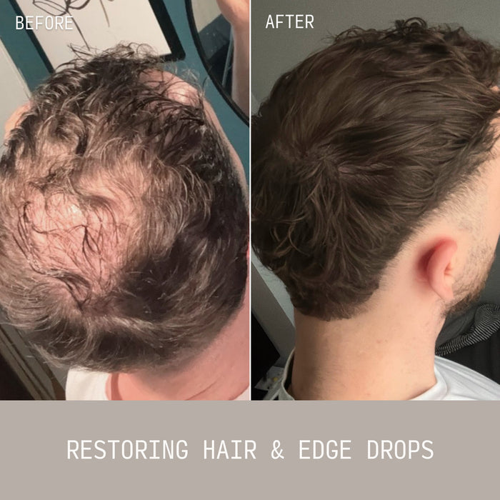 Side-by-side before and after comparison showing a man's crown with thinning, sparse hair before and visibly fuller, denser hair growth after using Cécred Restoring Hair & Edge Drops