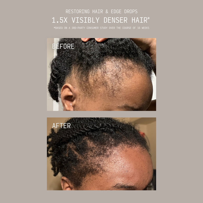 Stacked before and after comparison showing a person's hairline with sparse edges before and visibly fuller, denser edge regrowth after using Cécred Restoring Hair & Edge Drops, with text reading "1.5x Visibly Denser Hair"