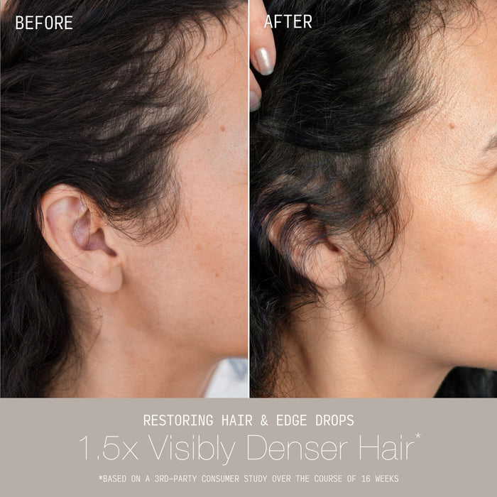 Side-by-side before and after comparison showing a woman's nape and hairline with thinning hair before and visibly fuller, denser regrowth after using Cécred Restoring Hair & Edge Drops, with text reading "1.5x Visibly Denser Hair"