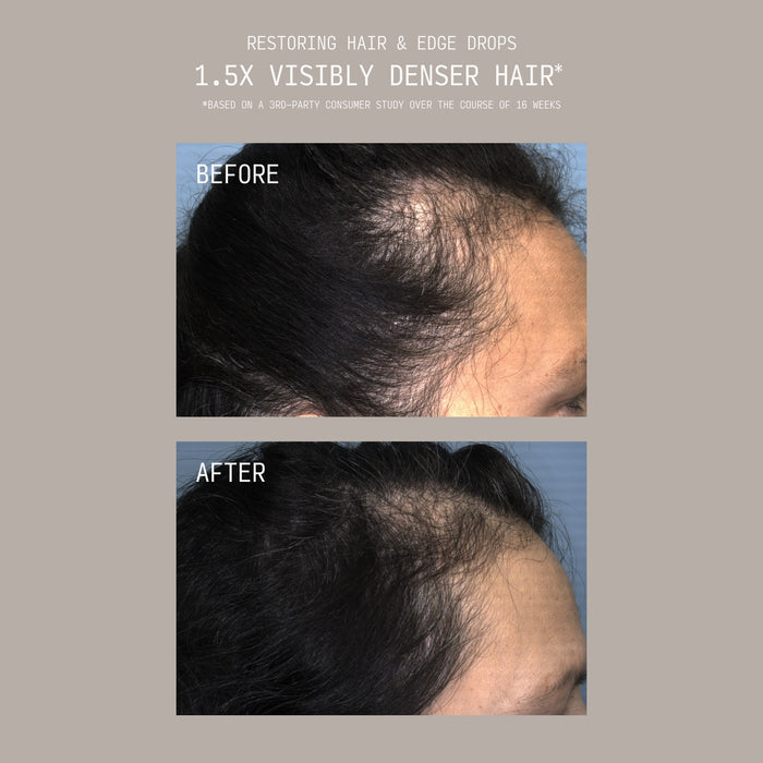 Stacked before and after comparison showing a woman's scalp and hairline with thinning, sparse hair before and visibly fuller, denser regrowth after using Cécred Restoring Hair & Edge Drops, with text reading "1.5x Visibly Denser Hair"