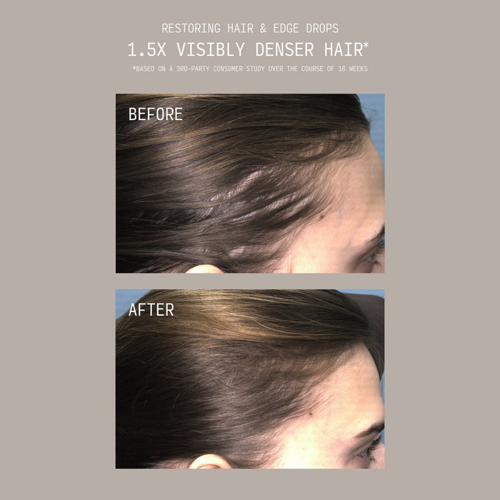 Stacked before and after comparison showing a woman's hairline and temple area with thinning hair before and visibly thicker, fuller regrowth after using Cécred Restoring Hair & Edge Drops, with text reading "1.5x Visibly Denser Hair"