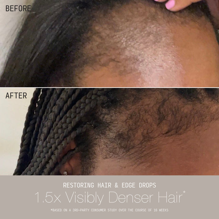 Stacked before and after comparison showing a person's hairline with severely thinning edges before and visibly fuller, restored edge regrowth with braids after using Cécred Restoring Hair & Edge Drops, with text reading "1.5x Visibly Denser Hair"